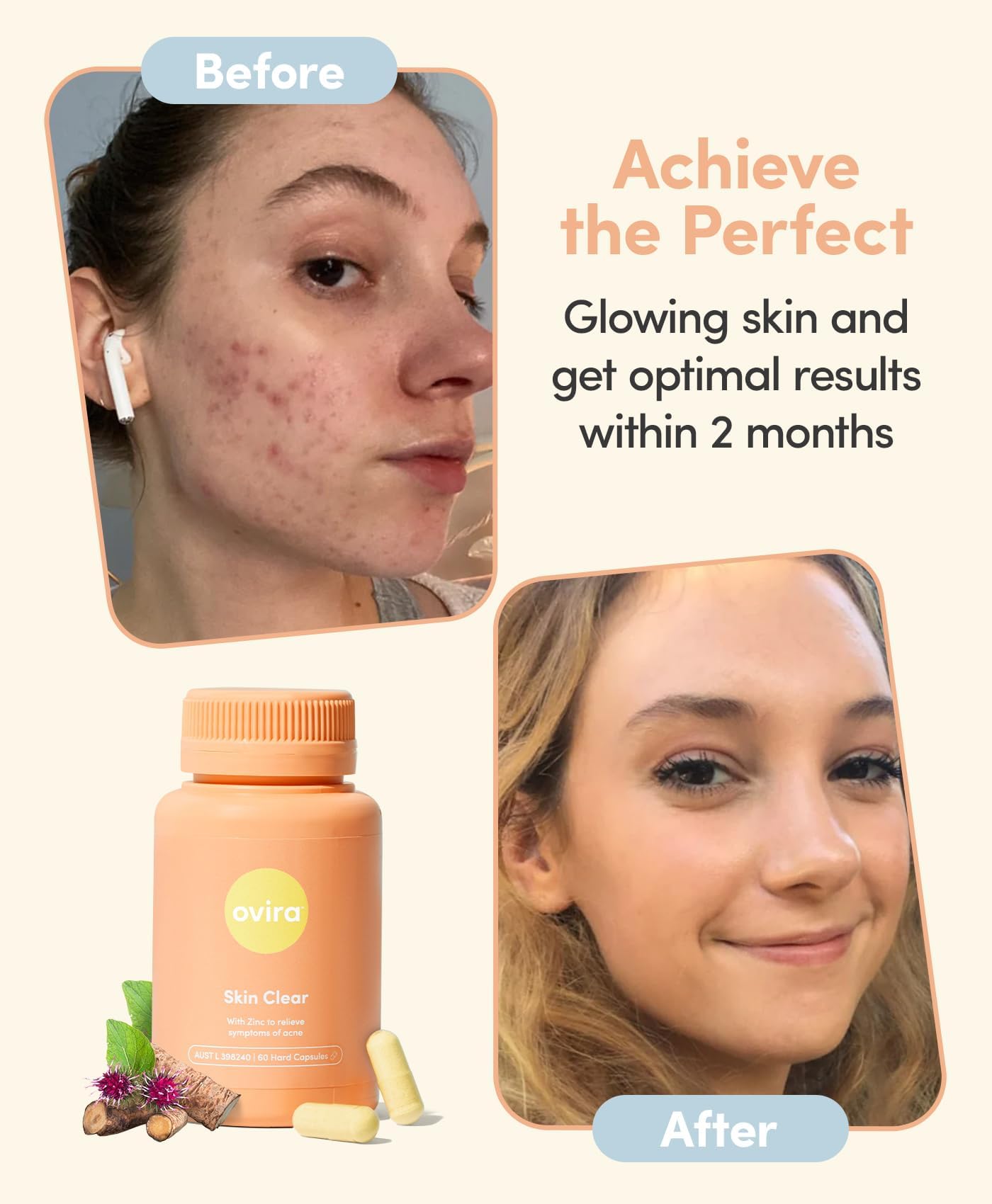 Ovira Skin Clear ZINCBRIGHT lifestyle image for morning routine and rosacea-friendly care.