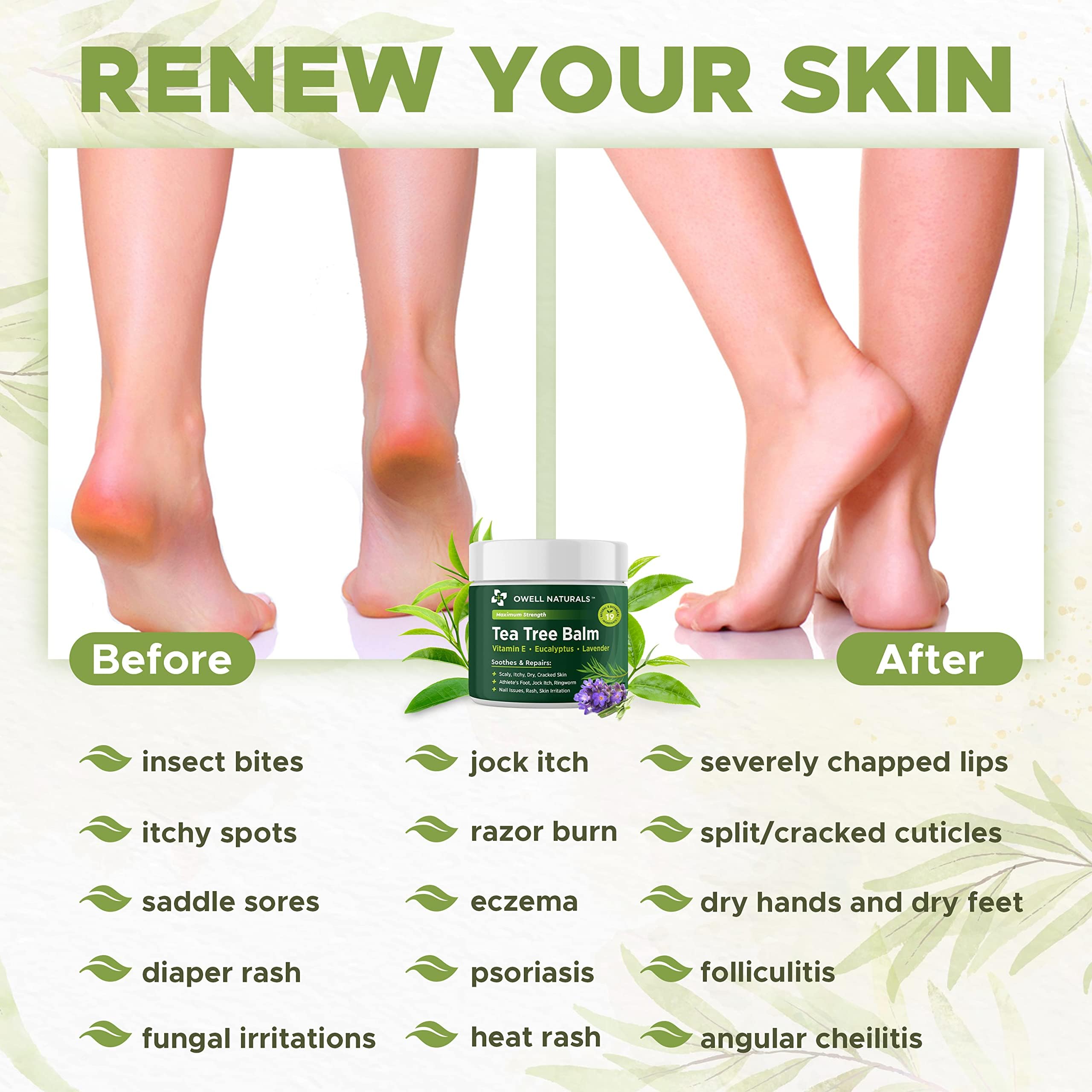 Owell Naturals Tea Tree Balm close-up texture reveals creamy, quick-absorbing formula.