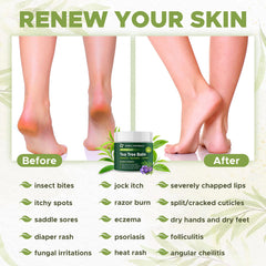 Owell Naturals Tea Tree Balm close-up texture reveals creamy, quick-absorbing formula.