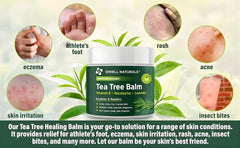 Owell Naturals Tea Tree Balm tube 2oz demonstrates easy application for itchy skin.
