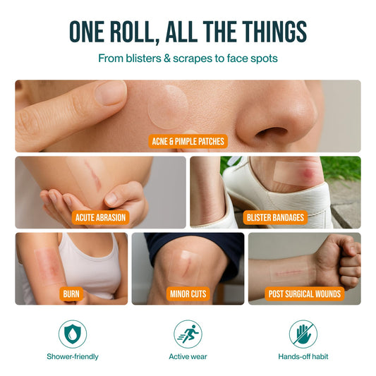 Patch4U hydrocolloid roll self-adhesive bandage keeping burns or blisters protected.