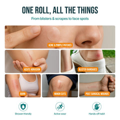 Patch4U hydrocolloid roll self-adhesive bandage keeping burns or blisters protected.