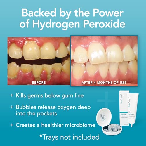 Perio Gel gentle whitening avoids sensitivity while brightening.