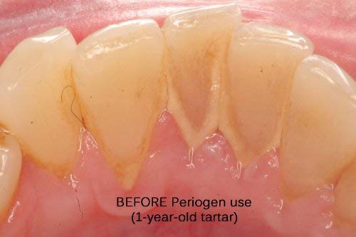 Three-bottle pack signals value and long-term tartar management.