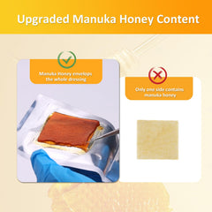 POLYNEW Manuka honey dressing 2x2 inch, ideal for burn care and gentle protection