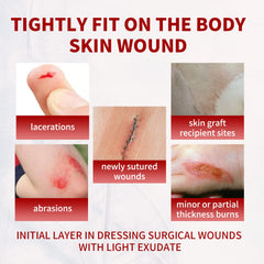 POLYNEW Xeroform dressing suitable for burns, abrasions, and lacerations in clinical or home care.