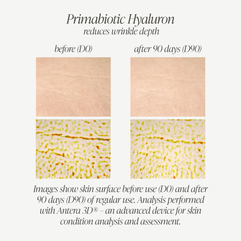 PRIMABIOTIC Hyaluronic Acid mango-ingredients graphic communicates plant-based hydration.
