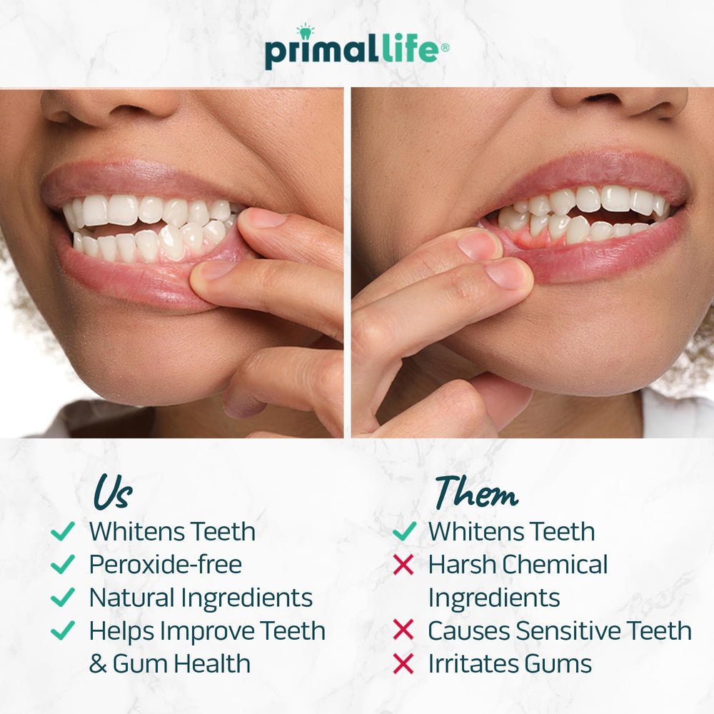 Primal Life Organics Real White Strips gel side applied to teeth for easy placement.