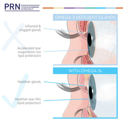 PRN DE Omega tear-film scene suggests potential eye comfort.