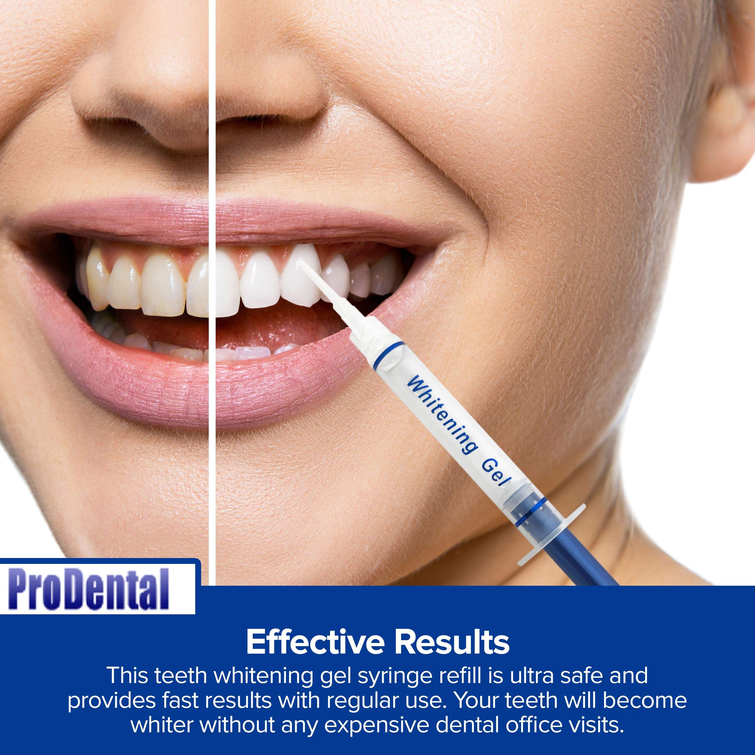 ProDental gel on tray during whitening session