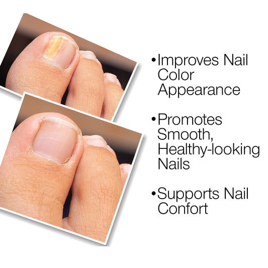 Probelle Nail Renewal Gel close-up showing improved color consistency and even tone