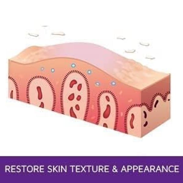 Prosoria ingredients include shea butter and vitamin E for nourishing skin