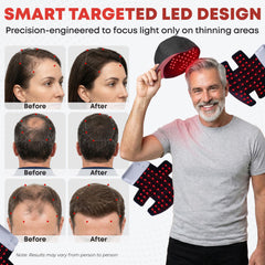 Prospek portable therapy hat in travel bag shows rechargeable convenience.