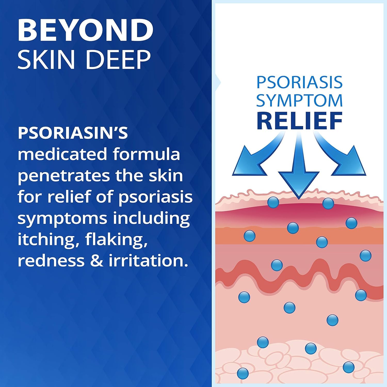 Psoriasin Deep Moisturizing Ointment on skin: soothing barrier to lock in moisture.