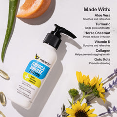 Pure Relief Arnica cream jar demonstrates soothing topical for bruising