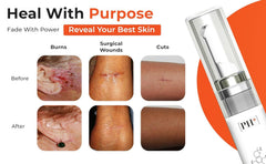 Scar area with improved texture and reduced redness