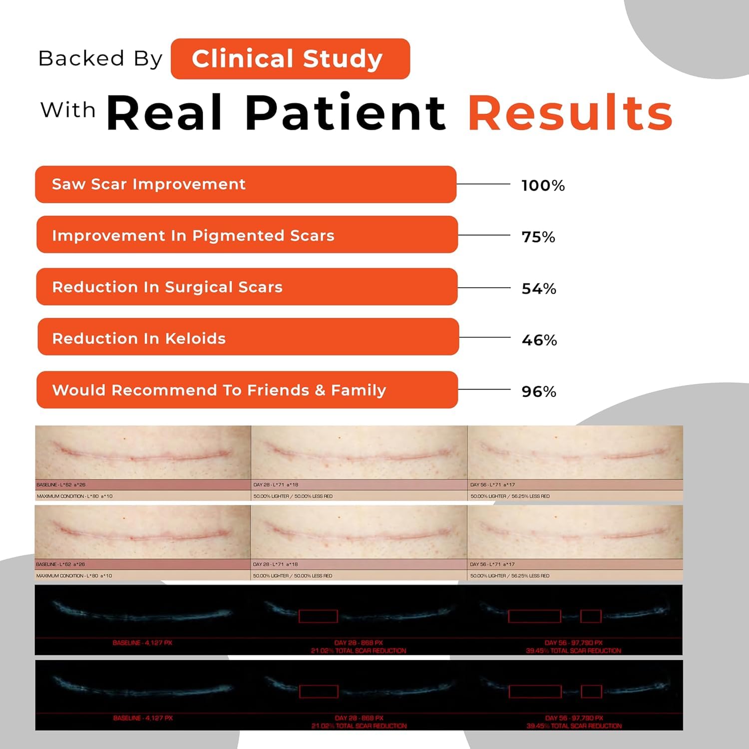 PureHealPlus silicone scar gel on skin aiming for smoother scar texture