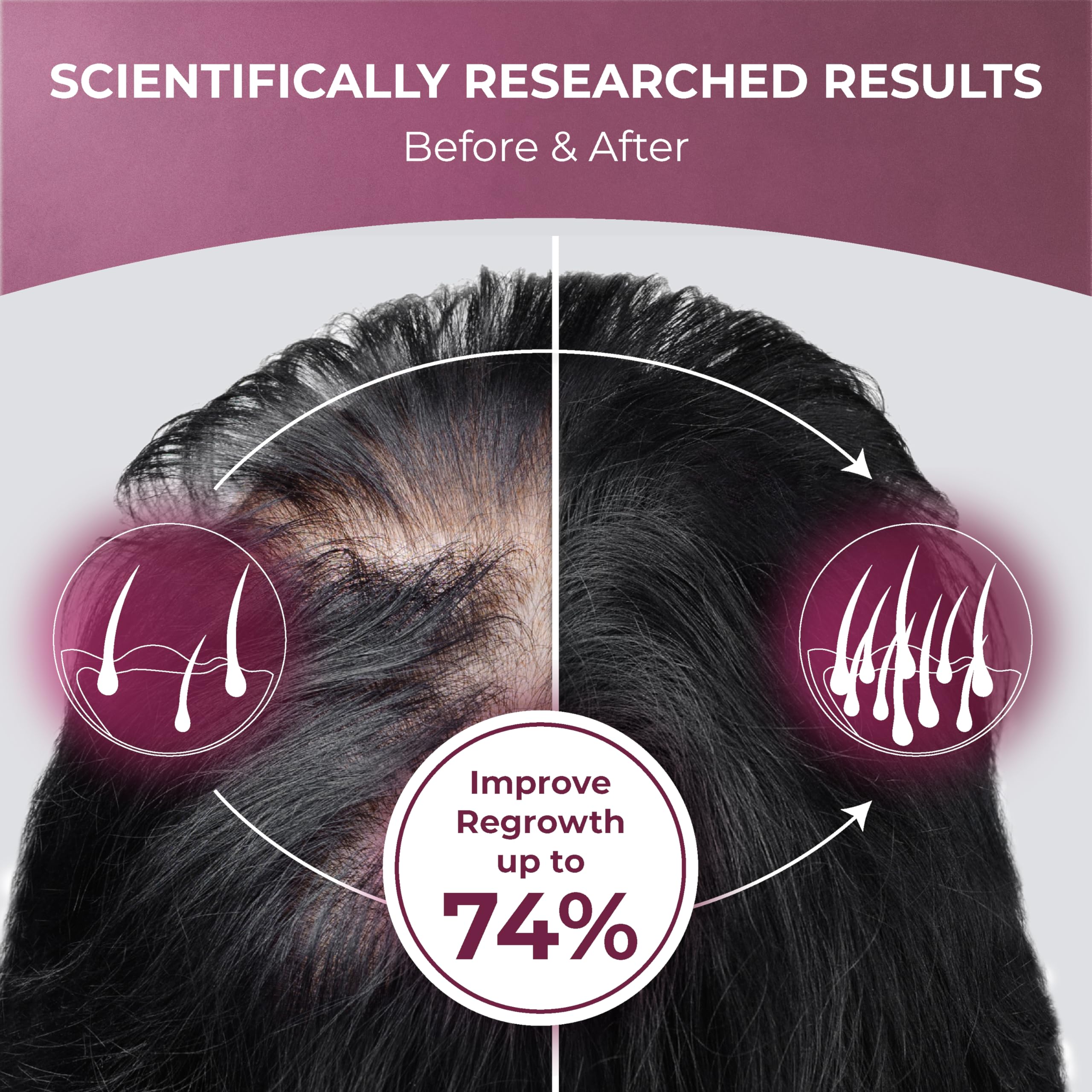 PUREHEALTH RESEARCH ReGrow packaging conveys premium, science-backed hair support.