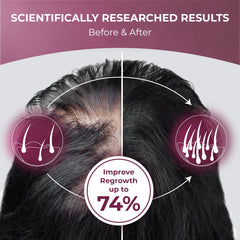 PUREHEALTH RESEARCH ReGrow packaging conveys premium, science-backed hair support.