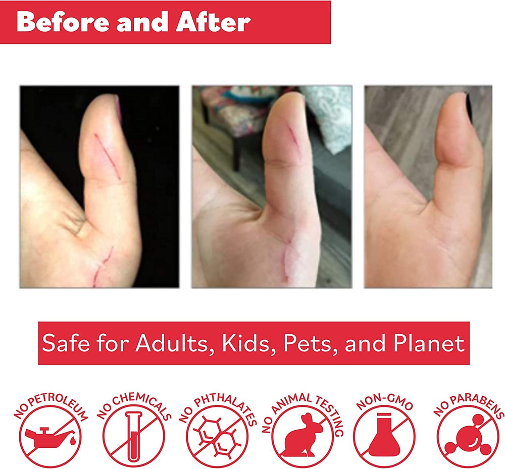 Applying Puremedy Ointment on skin to soothe minor irritation.