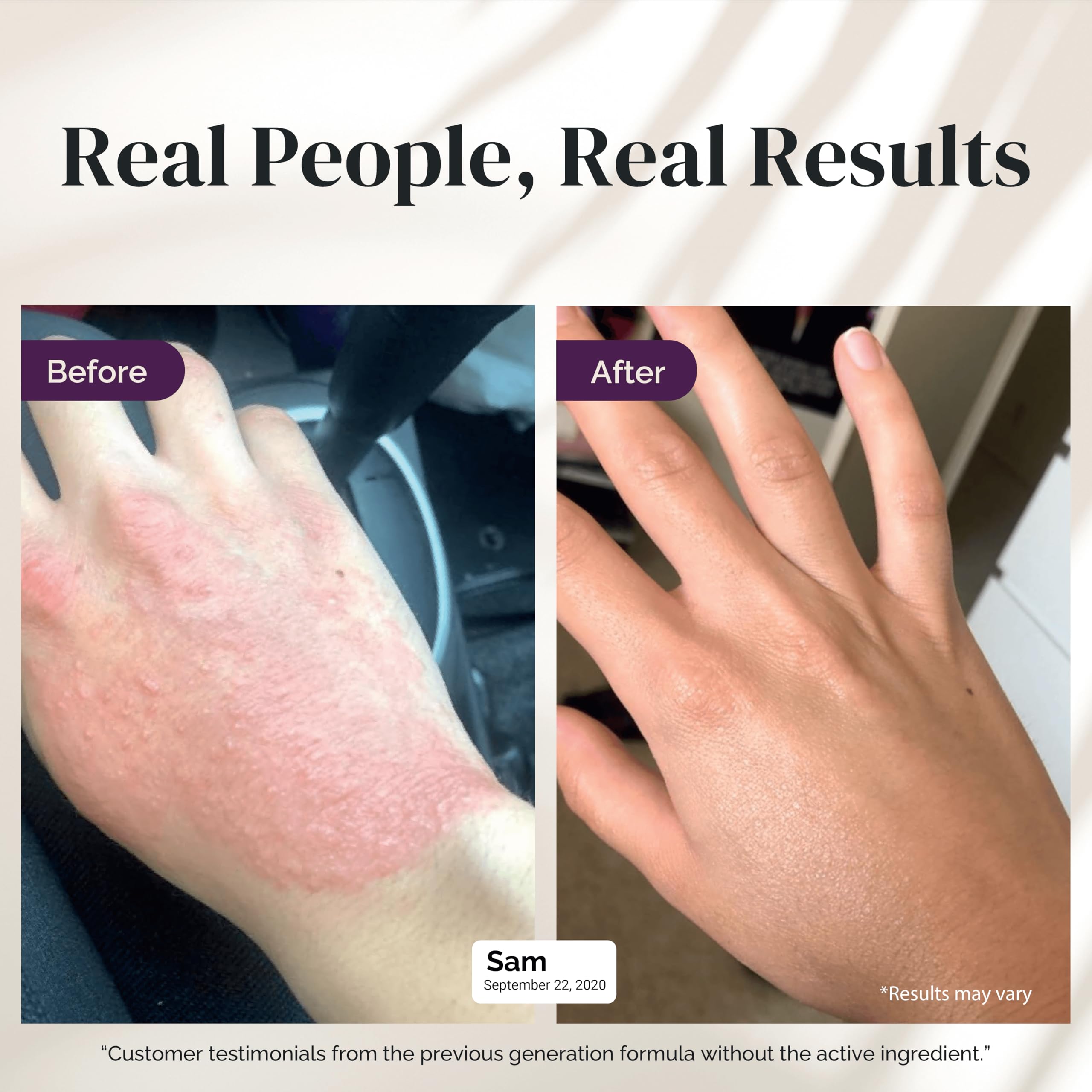 Puriya 5-in-1 eczema cream texture swirl highlights rich moisturization for sensitive skin
