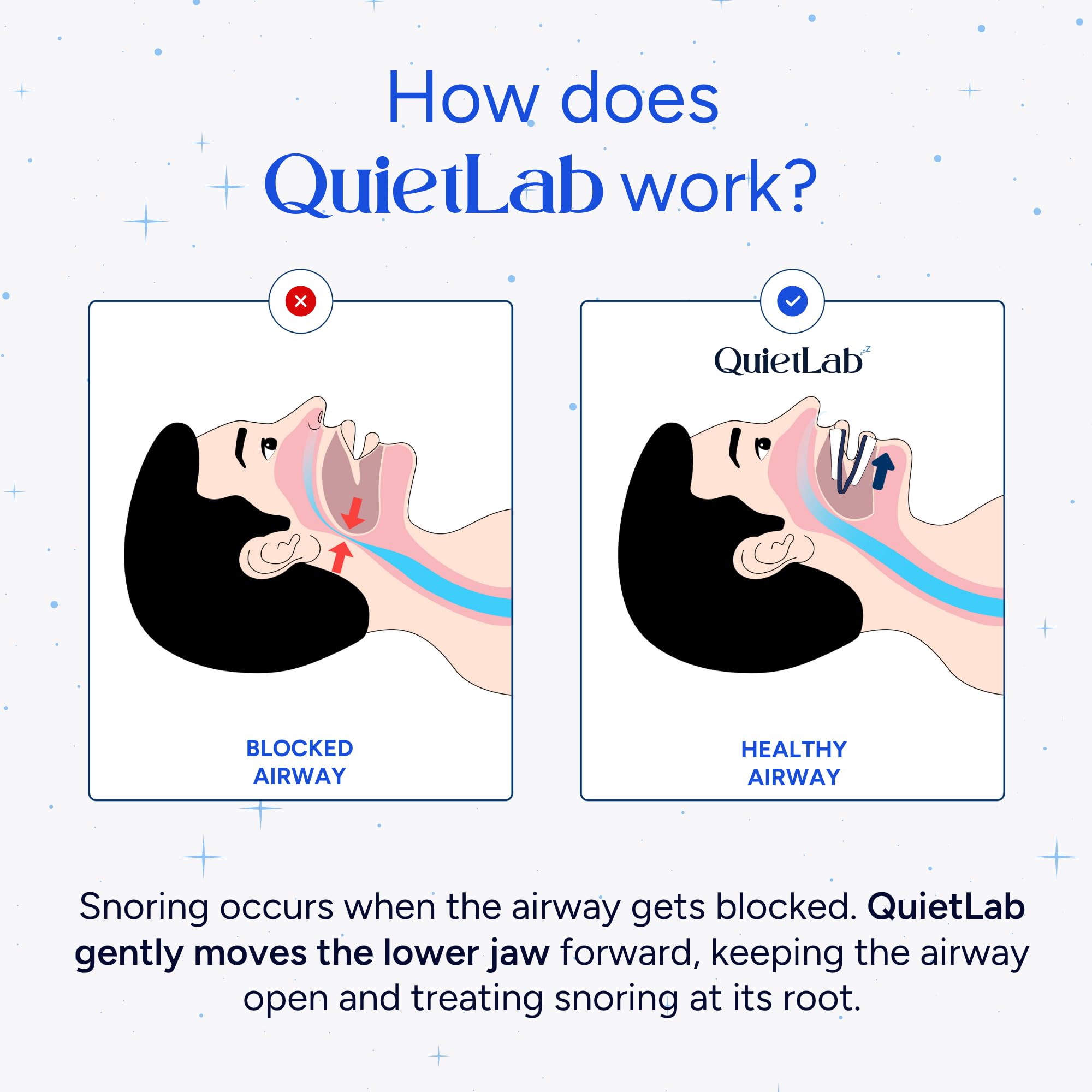 QuietLab Pro worn at night, ultra-thin and barely noticeable.