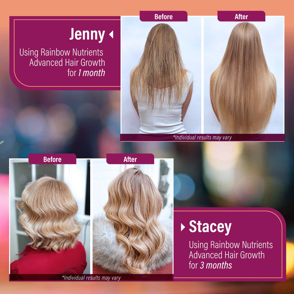 Rainbow Nutrients Hair Growth supplement pack ready for daily use.
