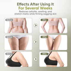 REDLOOK wireless design enables on-the-go contouring sessions.