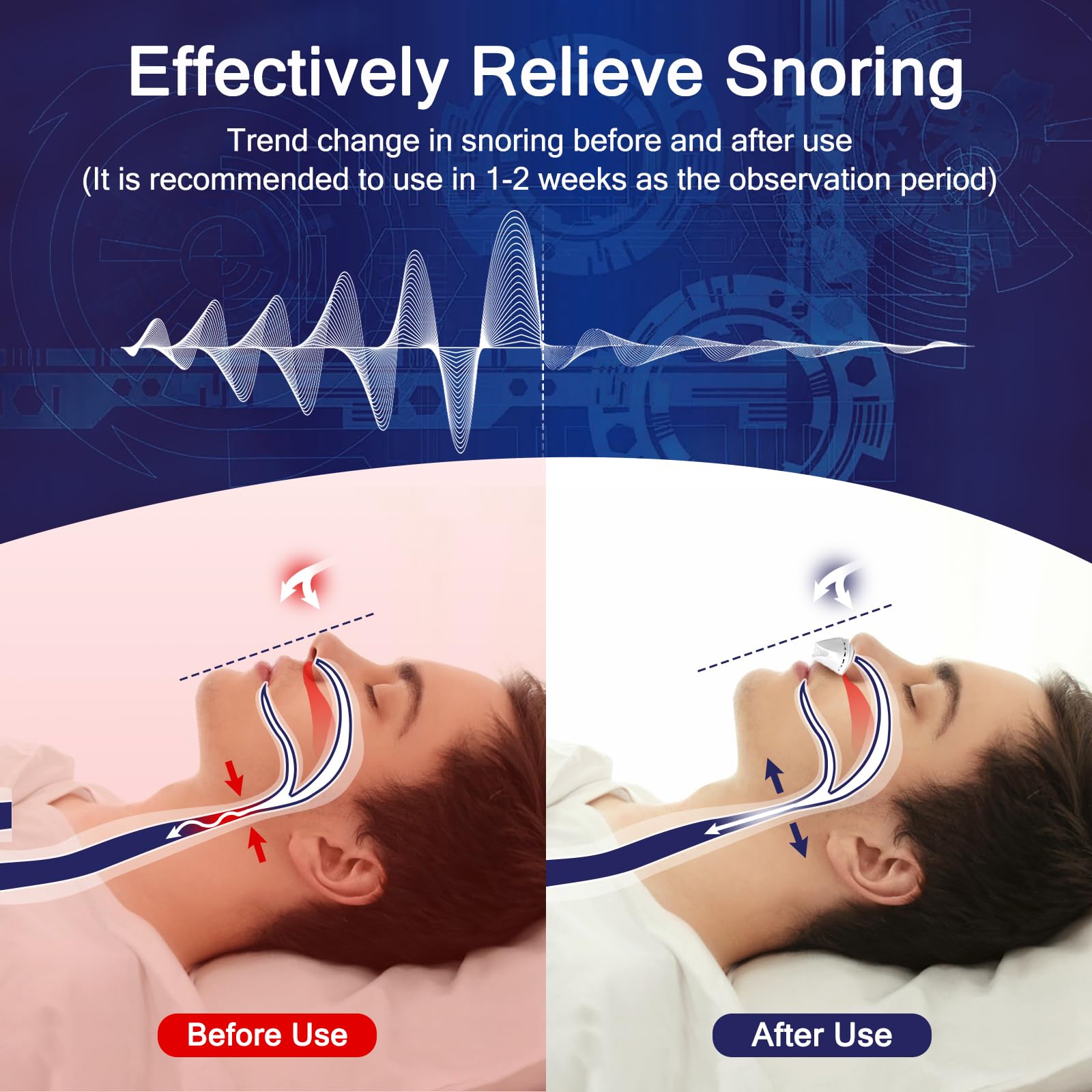 Redpee anti-snore device rechargeable via USB for travel use