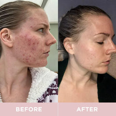 Graphic highlighting hyaluronic acid and aloe with Revive Collagen Premium ingredients.