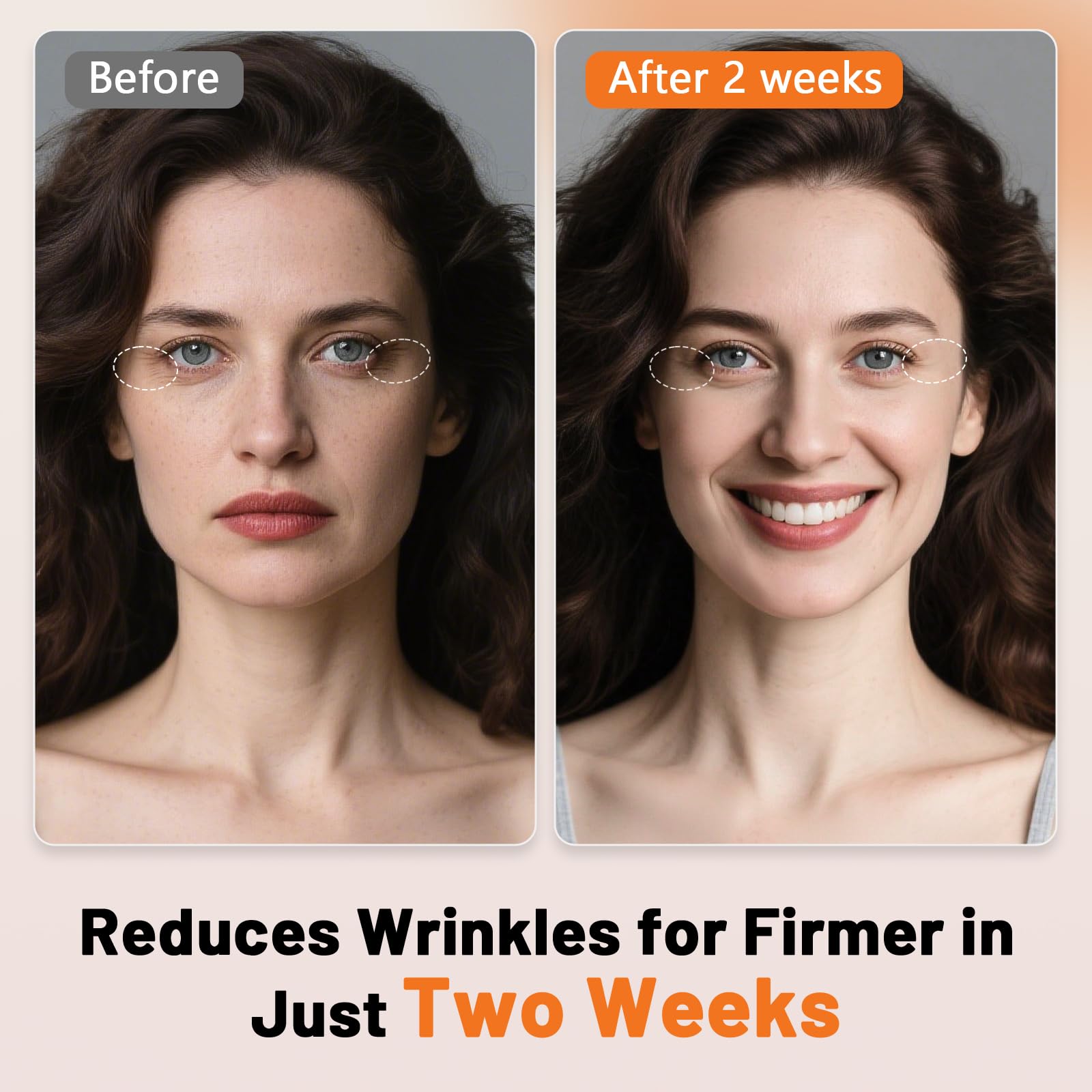 ROMISA dense 288-LED array provides even facial coverage.