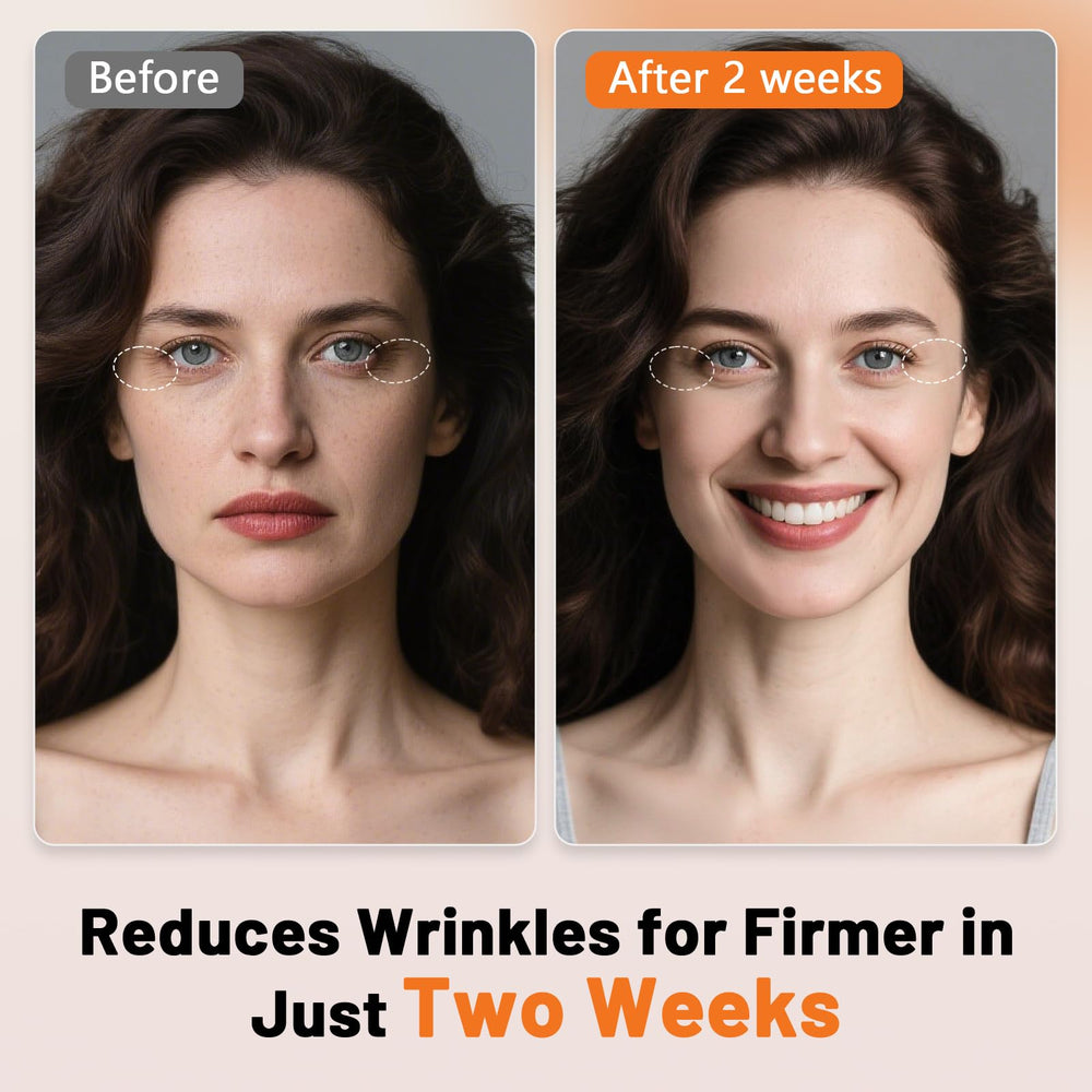 ROMISA dense 288-LED array provides even facial coverage.