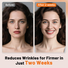 ROMISA dense 288-LED array provides even facial coverage.