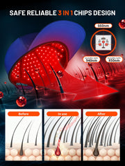 ROMISA red light cap 660nm red light for targeted scalp exposure
