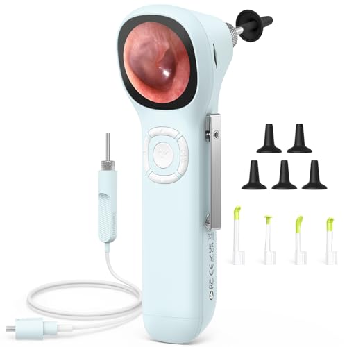ScopeAround Otoscope with light shows real-time visuals on built-in display.