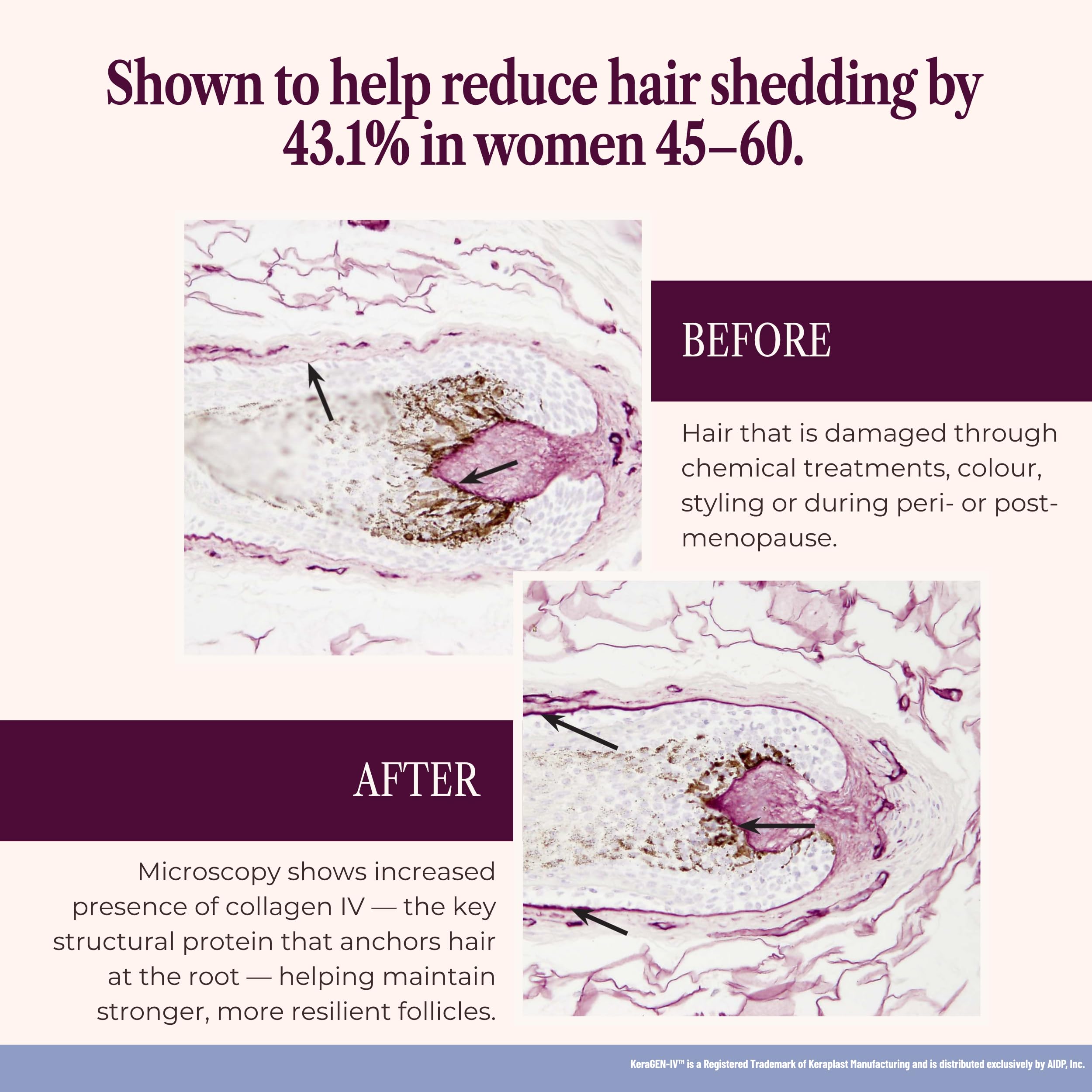 SEASON34 keragen-iv peptides close-up highlighting hair support.