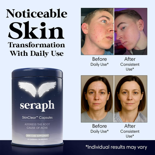Seraph Acne Supplement tablets shown for daily skin vitality.