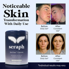 Seraph Acne Supplement tablets shown for daily skin vitality.