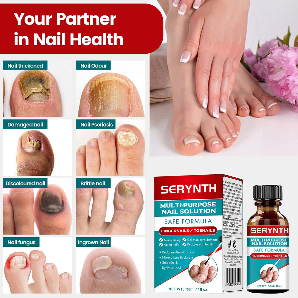 SERYNTH nail-progress suggests possible improvements with regular use over weeks