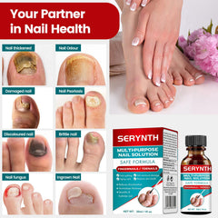 SERYNTH nail-progress suggests possible improvements with regular use over weeks