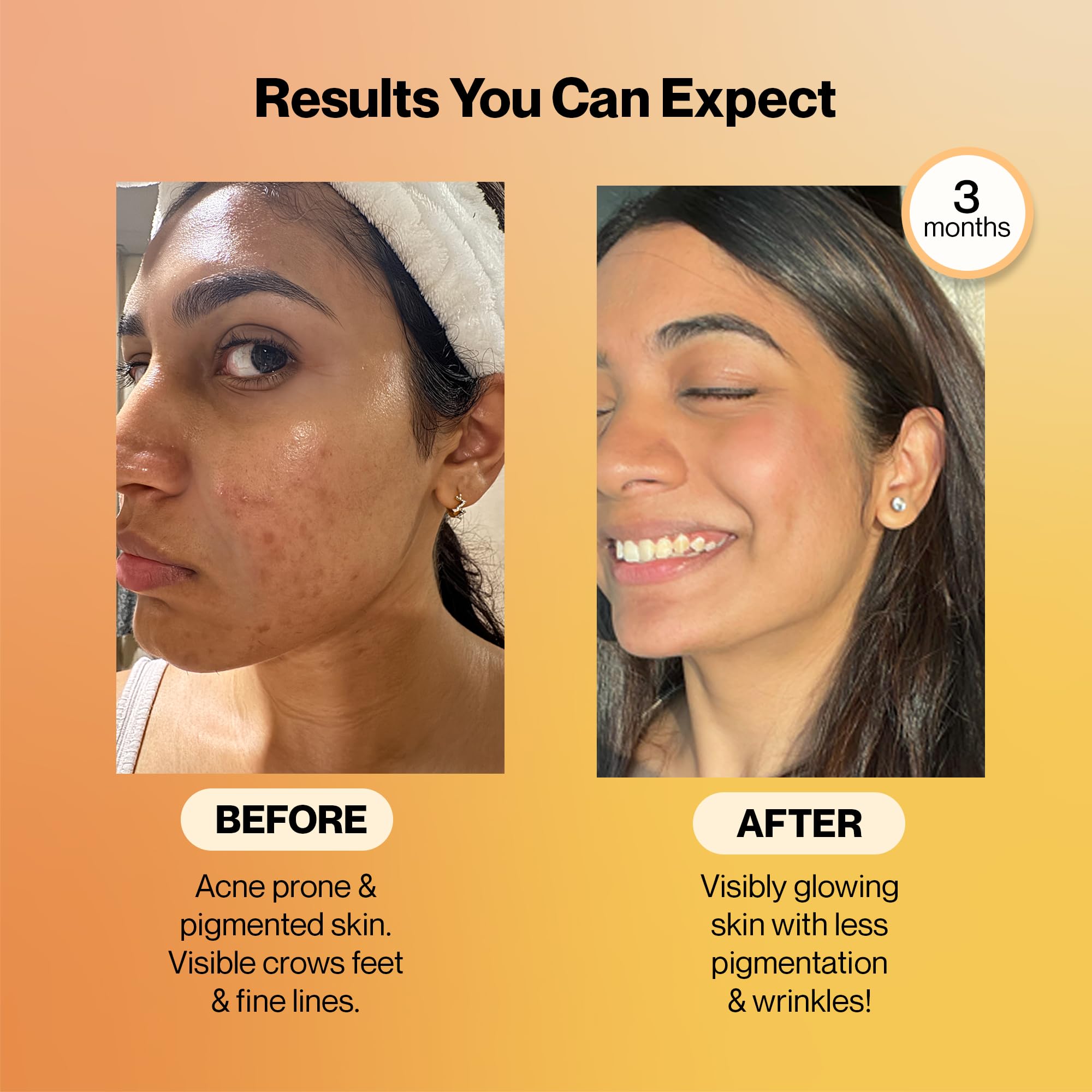 SETU Radiant Skin Combo ceramosides visual focuses hydration and skin suppleness.