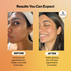 SETU Radiant Skin Combo ceramosides visual focuses hydration and skin suppleness.