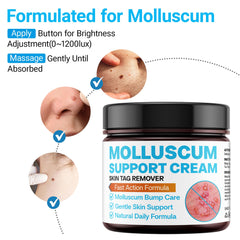 Applying SHUNNIUB molluscum cream to affected skin for gentle care