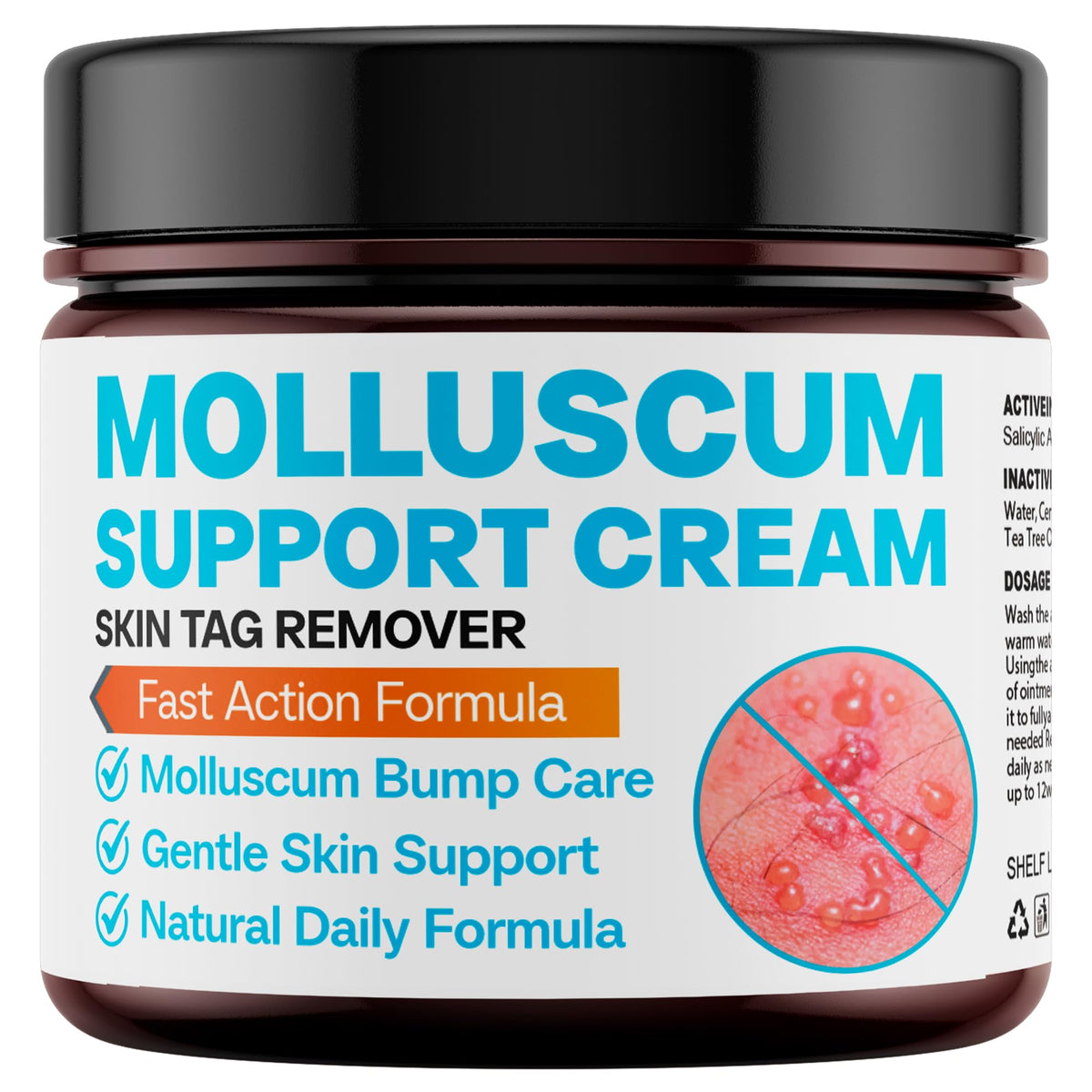 SHUNNIUB molluscum support cream bottle for daily skin care