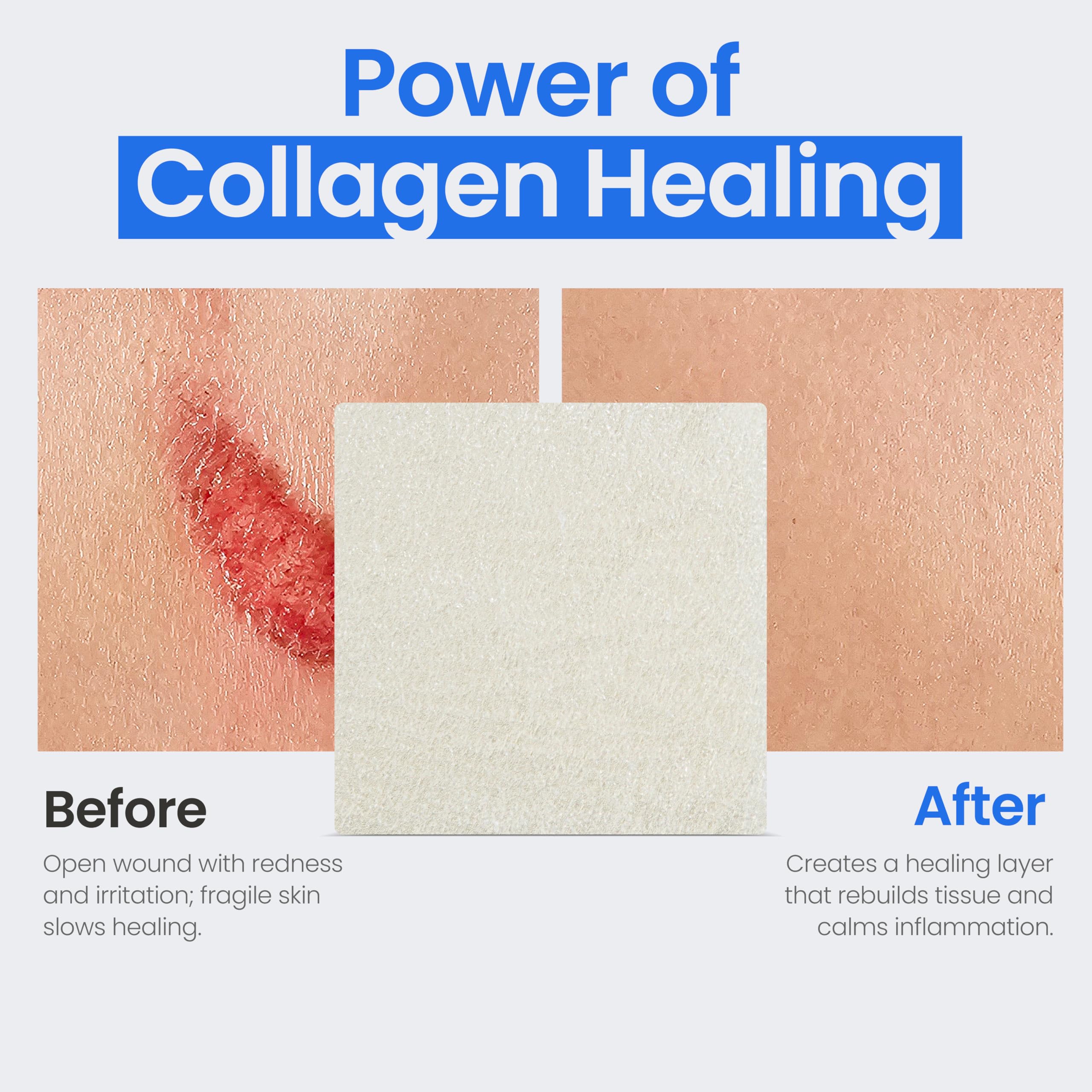 Simpurity collagen pad-cut-to-fit design adapts to wounds.