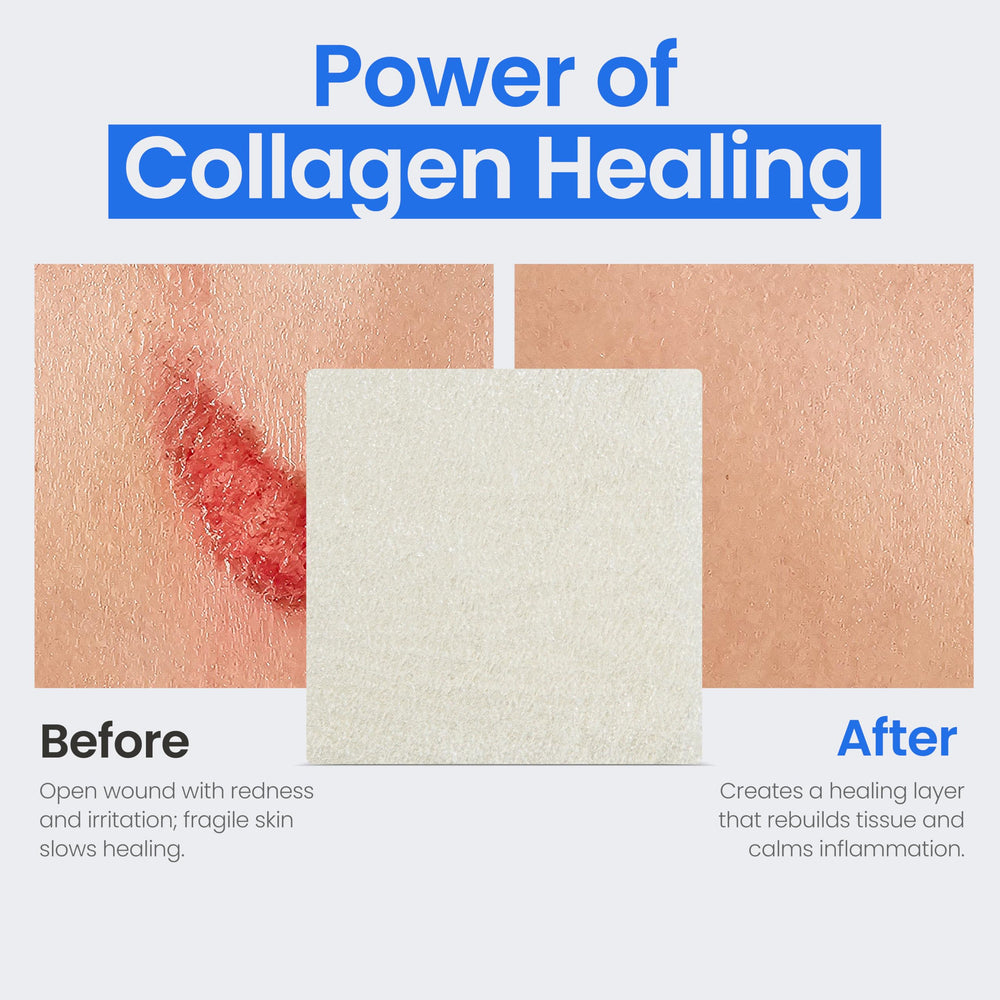 Simpurity collagen pad-cut-to-fit design adapts to wounds.