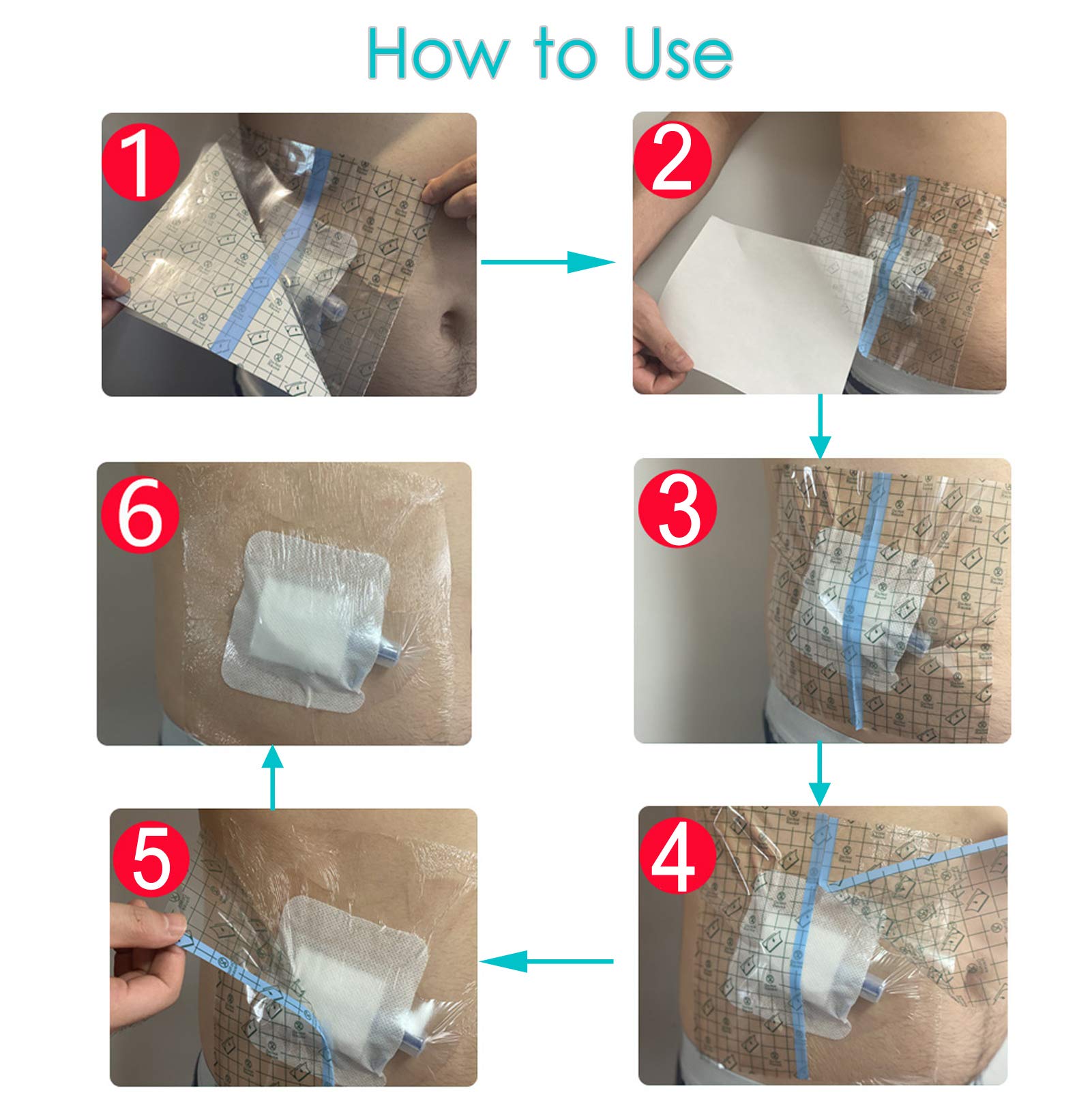 SinaiSea post-surgery shower shield supports worry-free bathing