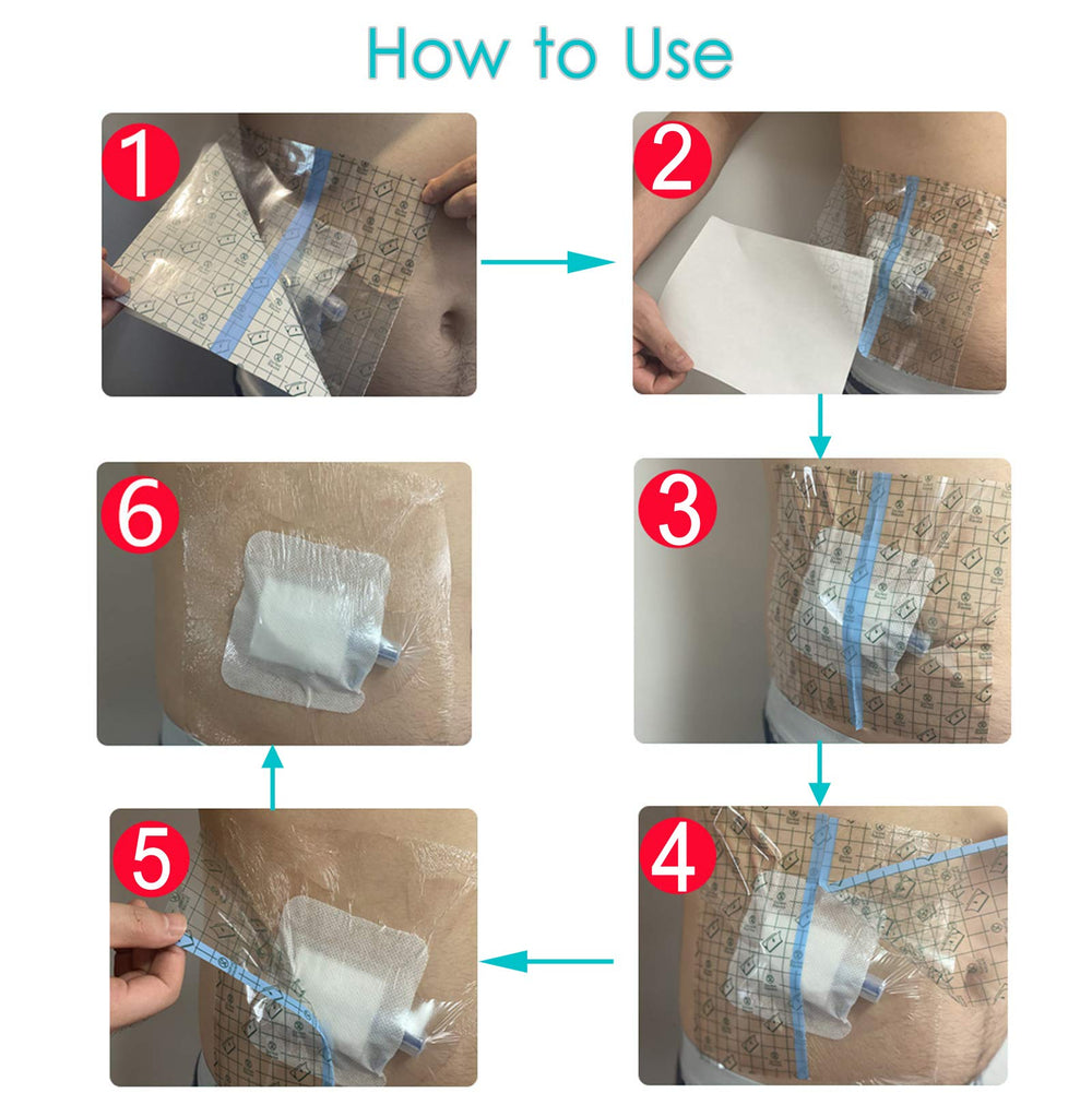 SinaiSea post-surgery shower shield supports worry-free bathing