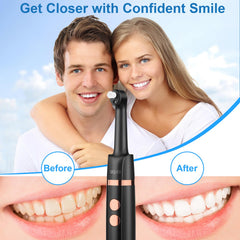 SIQUER Tooth Polisher includes mouth mirror for enhanced oral inspection