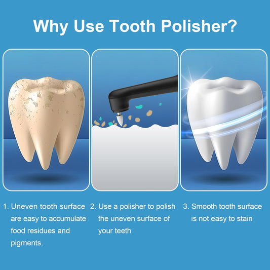 SIQUER Tooth Polisher shows built-in LED light for better plaque visibility